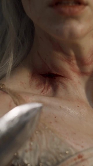 Episódio 6