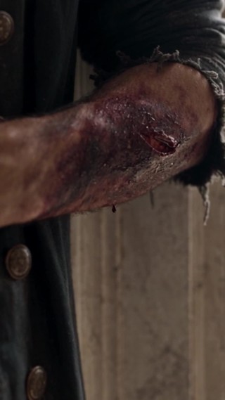 Épisode 17