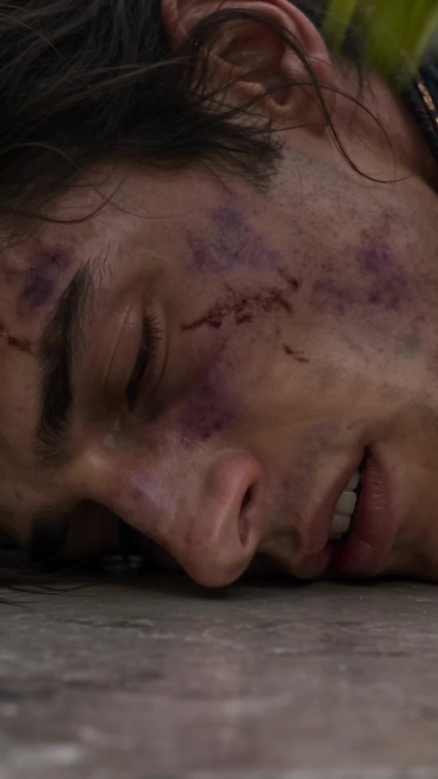 Episódio 28