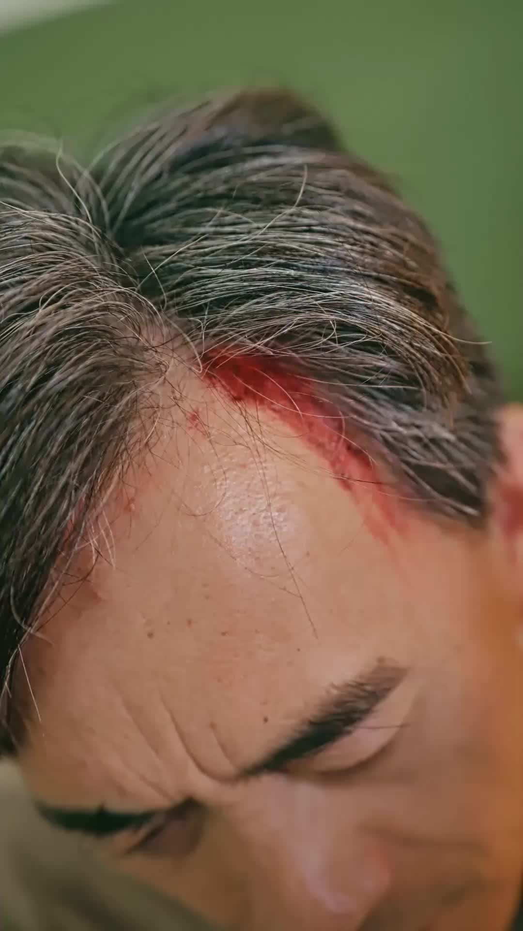 Episódio 18