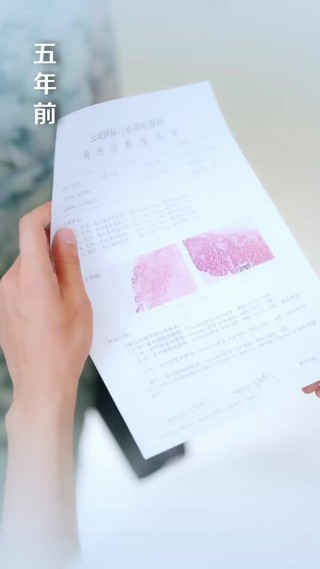 集 2