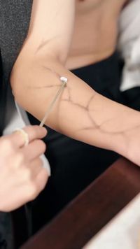 集 17